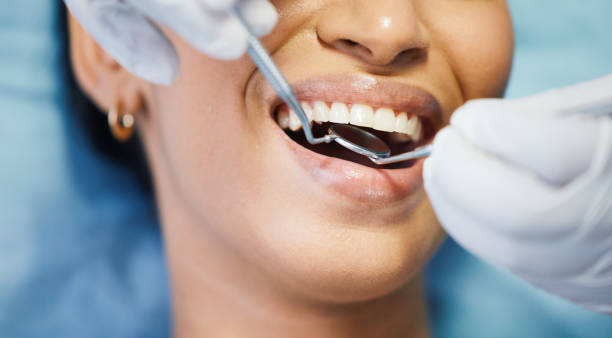 Best Emergency Denture Repair in Bremen, IN